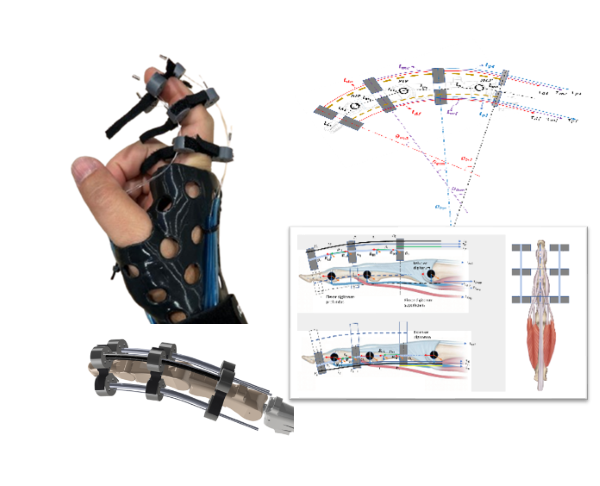 Mechatronics Example: Finger assistance