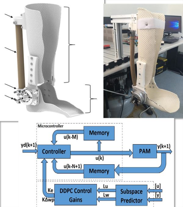 Mechatronics Example: Leg Cast